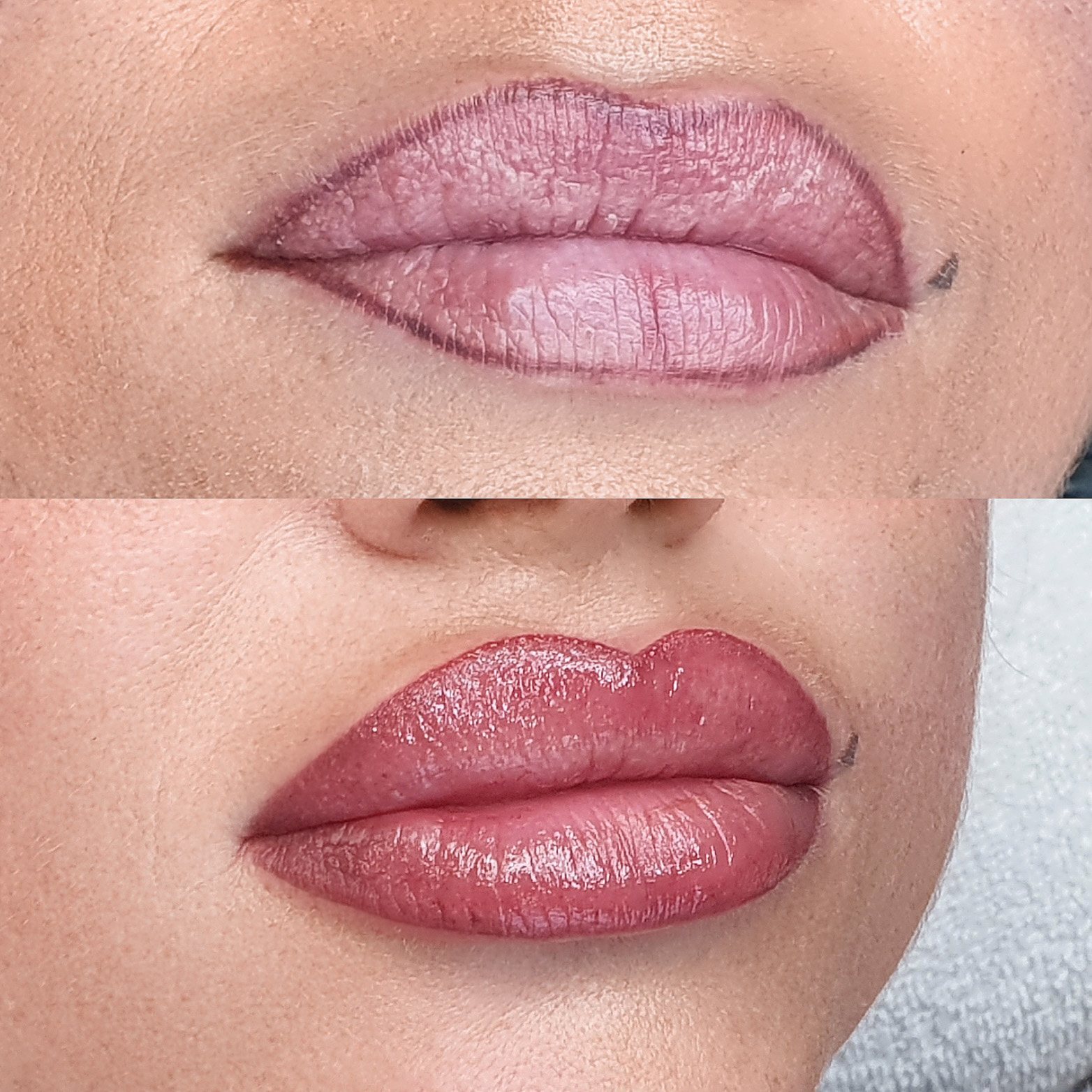 Vorher-Nachher-Ansicht einer Lippenpigmentierung